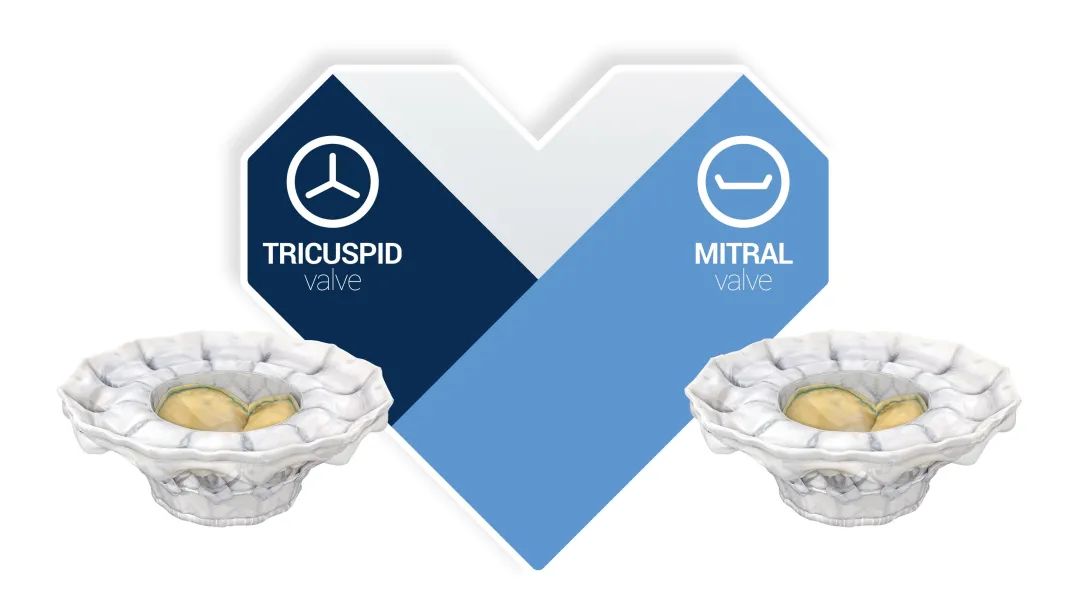 Qiming Medical completes acquisition of 100% of Cardiovalve's shares