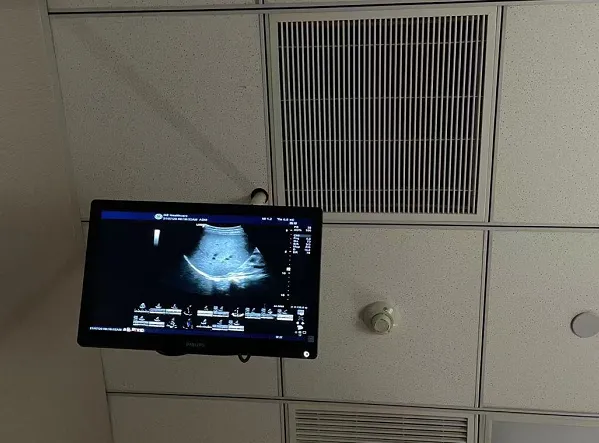 In 2019, Rui Ci Medical Chairman Fang Yixin said at an investor communication meeting. When Rui Ci went public, it only had one comprehensive hospital and some medical examination institutions. At that time, the company's market cap was 4 billion. As a result, the company worked hard, continuously expanded and explored, and made certain breakthroughs in its business model over a period of 2 years. However, the market cap fell by 20 billion, simply because the company did not make a profit from a financial statement perspective. Source: Futu; K-line chart of Rudig Medical stock price; Data as of Sunday, July 25, 2021. In fact, Rudig Medical has been working hard on the right path, with experience in managing general hospitals, and has determined the direction of medical examinations and specialized services for women and children. Over the past few years, the company has been continuously branching out. From the company's business data, all of its business indicators have been consistently improving, even after being affected by the 2020 pandemic, the company's profitability is still increasing and is expected to achieve positive returns this year. Source: Company Annual Report. 1. Scarce High-Quality Hospital Assets Rudig Hospital, affiliated with Nantong University, is China's first private comprehensive hospital. For Fang Yixin and his wife, who have a background in medicine, opening a hospital is to some extent the realization of a life goal. Therefore, observing the establishment of Rudig Hospital in the past 20 years, you can clearly feel the steady pace of the management, which is in stark contrast to the extensive management brought about by the capital expansion of Putian hospitals. 1. Strong comprehensive strength: Rudig Hospital has gradually grown from a small hospital to a comprehensive hospital over the past 20 years, undergoing a transformation...
