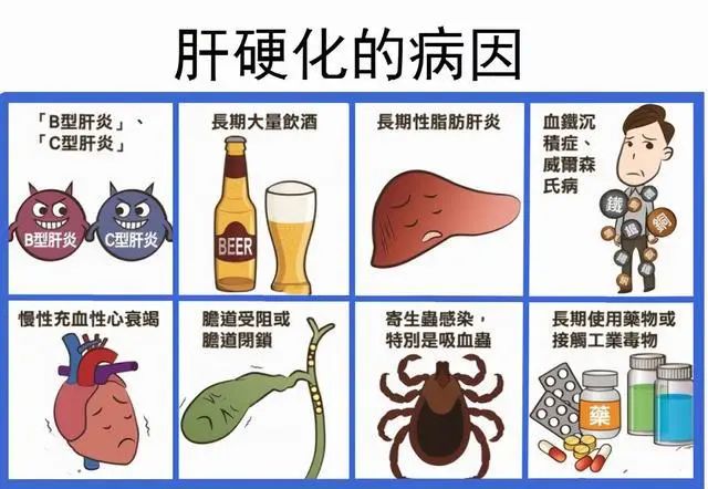 ★ NEWS ★ 近期，國內王福生院士的最新研究結果顯示，臍帶間充質幹細胞顯著改善失代償性肝硬化的肝功能及長期生存率。相關研究結果（預印本）在國際肝病學雜誌（Hepatology International）審議中。 共有219例患者納入研究，其中108名患者接受幹細胞治療，111名患者作爲對照組，並進行了長達75個月的隨訪。結果顯示，臍帶間充質幹細胞可以減輕肝素的氨基轉移，明顯改善肝臟功能，並且幹細胞治療組的總體生存率高於對照組。這一研究給間充質幹細胞治療肝硬化的安全性和有效性提供了新的證據。 01 王福生院士研究結果 研究方法：該研究納入291例失代償性肝硬化患者，分爲111人的對照組和108人的臍帶間充質幹細胞治療組，治療組每隔4周進行一次輸液，總計輸液三次。從2010年10月開始對所有患者進行持續7年的隨訪調查。 結果：治療組總生存率明顯高於對照組。從血清血蛋白、膽鹼酯酶和總膽紅素水平等指標來看，間充質幹細胞治療顯著改善了肝功能，且未觀察到明顯的副作用或治療相關併發症。 結論：間充質幹細胞治療不僅耐受性好，而且能顯著提高...