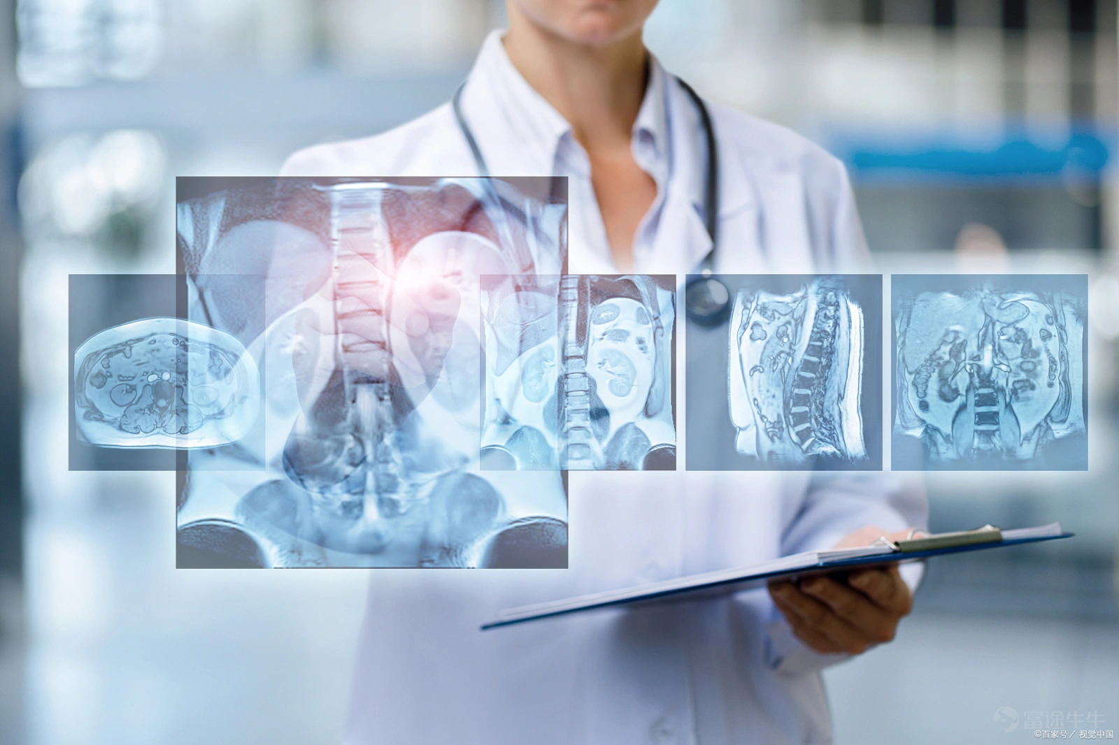 $DIAGENS-B (02526.HK)$ Following the filing for the Hong Kong Stock Exchange Main Board at the end of June 2025, Hangzhou Dexi Biotech Co., Ltd. (hereinafter referred to as 'Dexi Biotech') has recently resubmitted its listing application, with Huatai International acting as the sole sponsor. At the same time, Dexi Biotech’s Hong Kong stock listing was approved by the CSRC for record-filing. If all goes smoothly, the company is one step closer to a successful listing. Core Product Set to Become World's First? AI Adoption at Only 1% According to the prospectus, Tianyancha, and the official website, Dexi Biotech was founded in September 2016. The company provides intelligent and standardized imaging equipment, Model-as-a-Service (MaaS) cloud platforms, and localized self-training solutions to global medical institutions, research organizations, and enterprises. Leveraging its self-developed universal medical imaging foundational model iMedImage, the company has successfully built a diversified portfolio of smart devices and complementary products, including the Auto Vision® Chromosome Karyotyping Analysis System, MetaSight® Automated Cellular Microscopic Image Scanning System, Kayo Flow® Automated Cell Harvesting Instrument, and integrated slide preparation and staining machines, which meet various clinical scenarios. The company’s clients have expanded to over 400 healthcare centers and medical institutions nationwide, gaining widespread market recognition. The company offers a diversified product portfolio that can effectively enhance diagnostic efficiency and service quality, including six medical imaging software products...