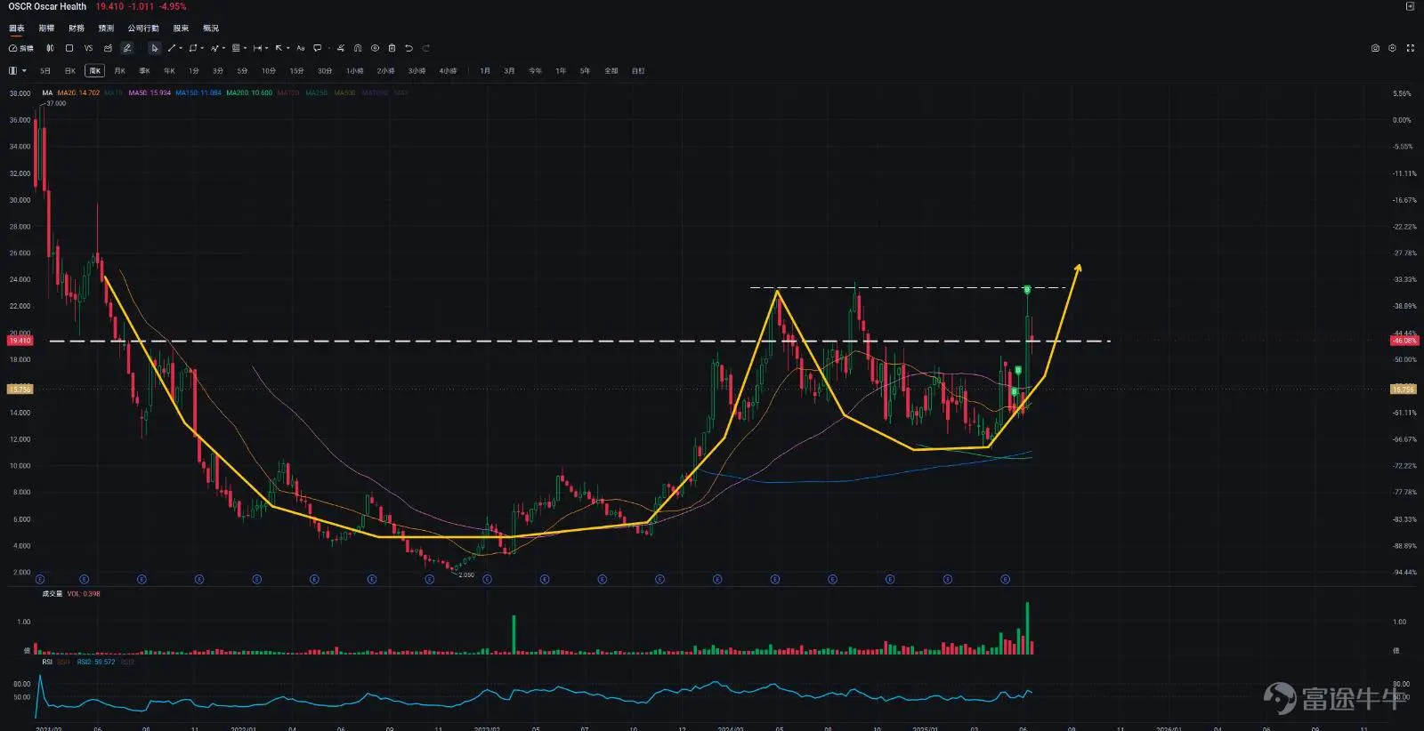 OSCR 杯柄形態